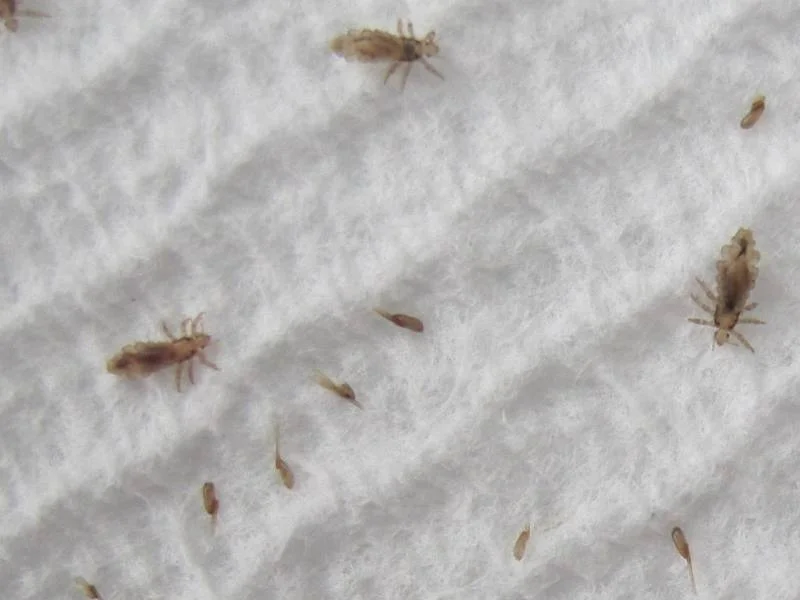 Nit Pic with Adult Lice