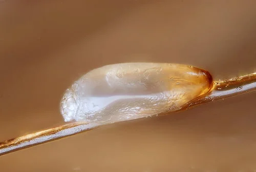 Head lice nit - egg
