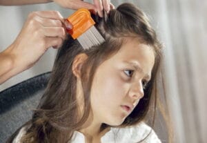 head lice removal