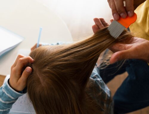 Professional Lice Screening