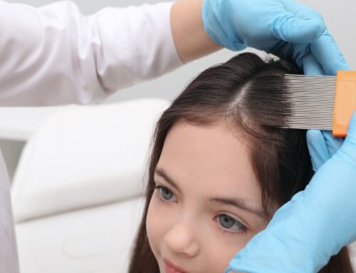 Lice Salon Treatments