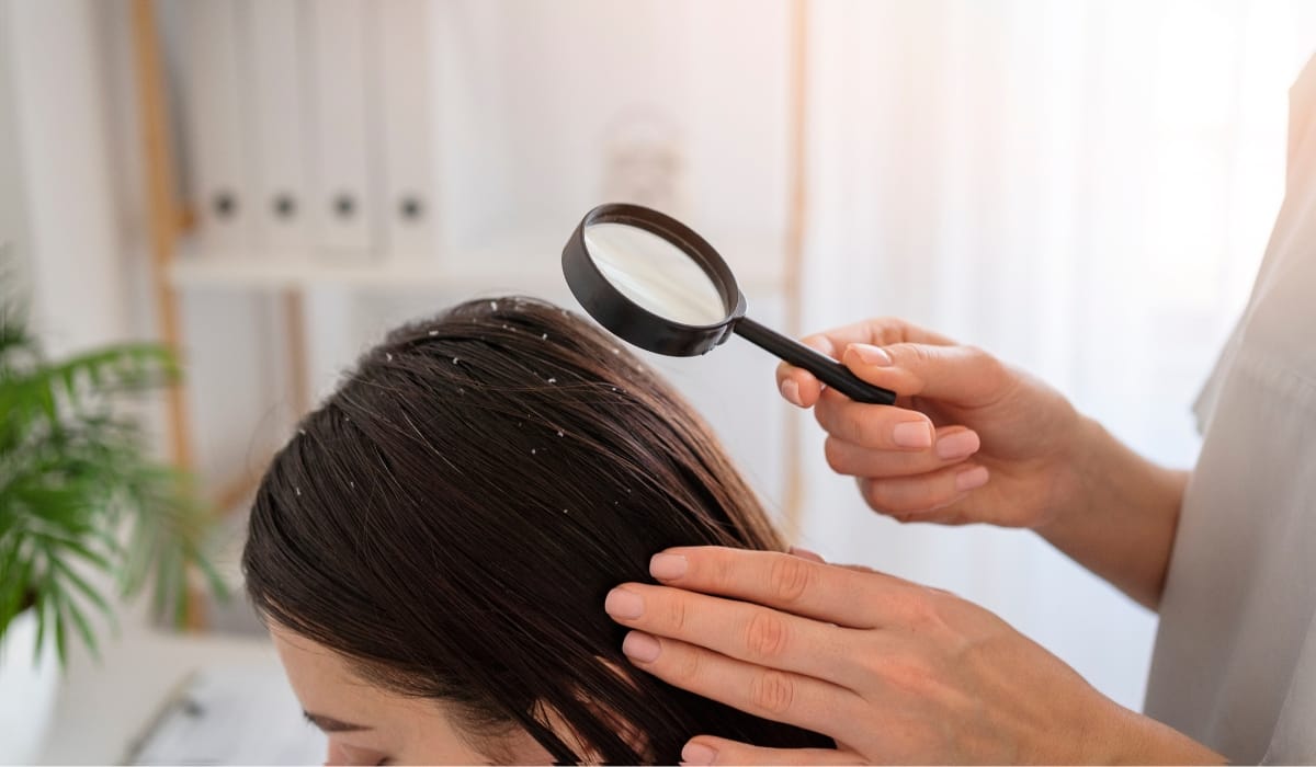 Lice removal treatment at home