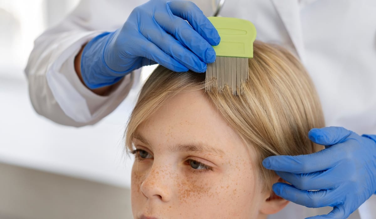 Professional lice screening process