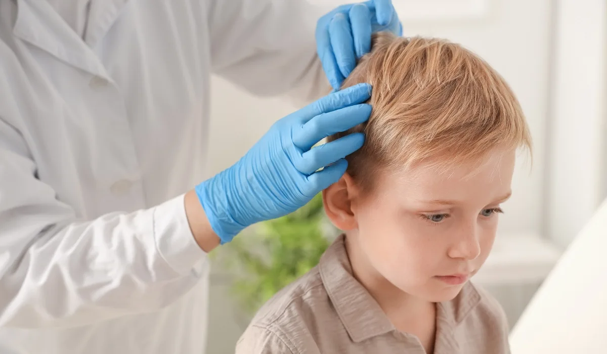 Treatment for lice in children using a Seattle