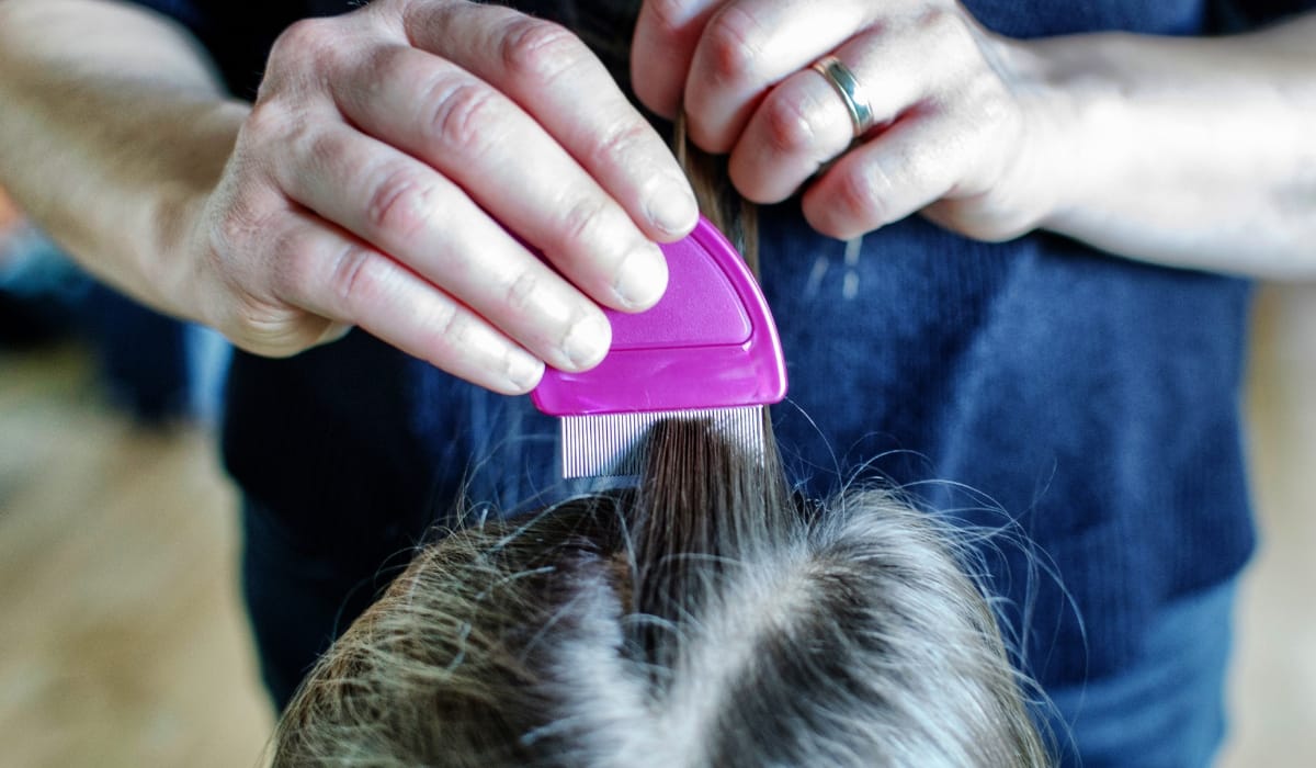 Expert nit removal service in Seattle