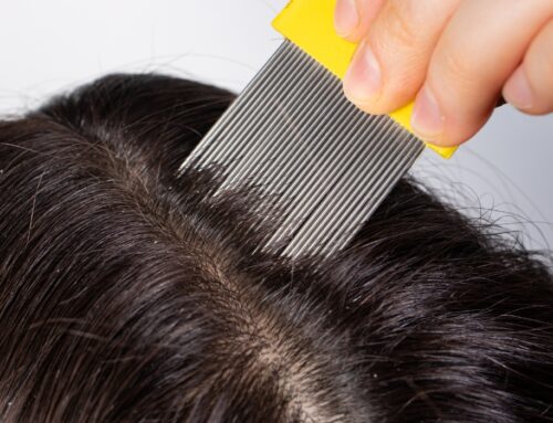 Lice Inspection Services